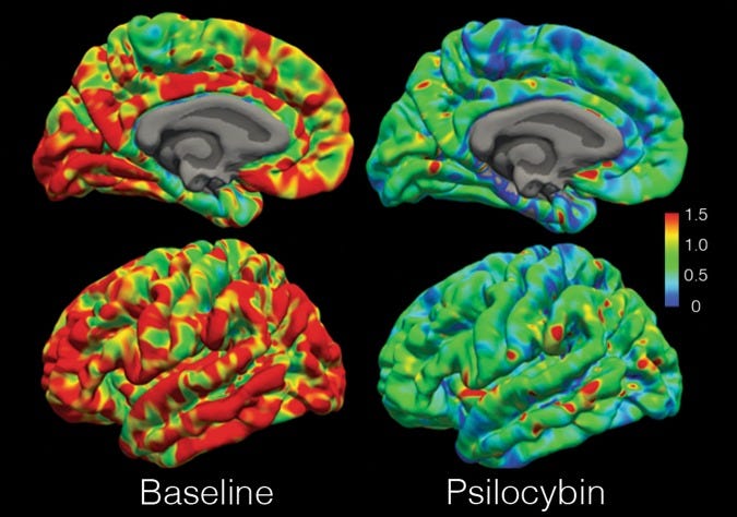 Psilocybin occupancy of 5-HT2AR. National Library of Medicine