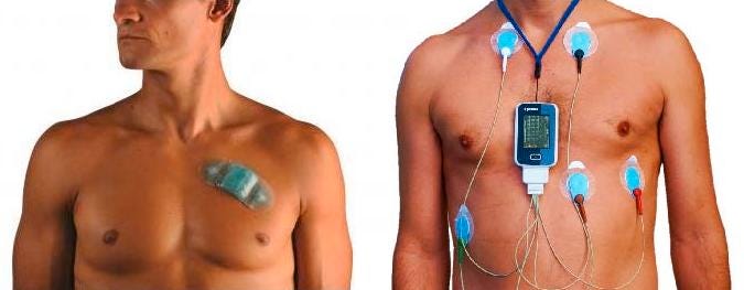 How Arduino based Holter ECG identifies the irregular heart beats ?