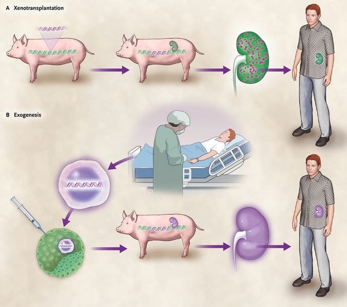 When Hope Meets Science: The Longest Pig Kidney Transplant in a Human and What It Means for the…