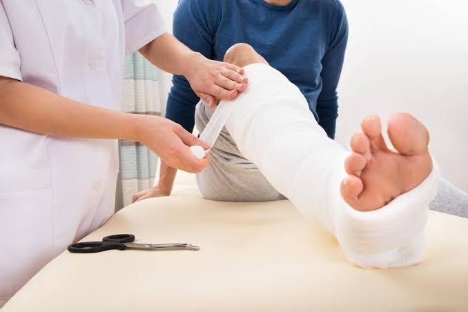 Why Immediate Fracture Treatment in Khar West Matters