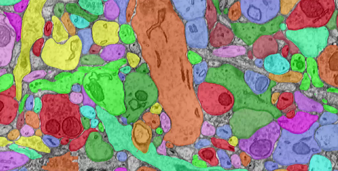 Surface Crack Detection