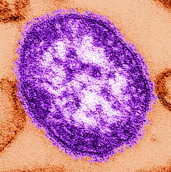 Digitally-colorized, thin-section transmission electron microscopic image of a single measles virus particle, with the viral nucleocapsid situated underneath the viral envelope, surrounded by surface projections.