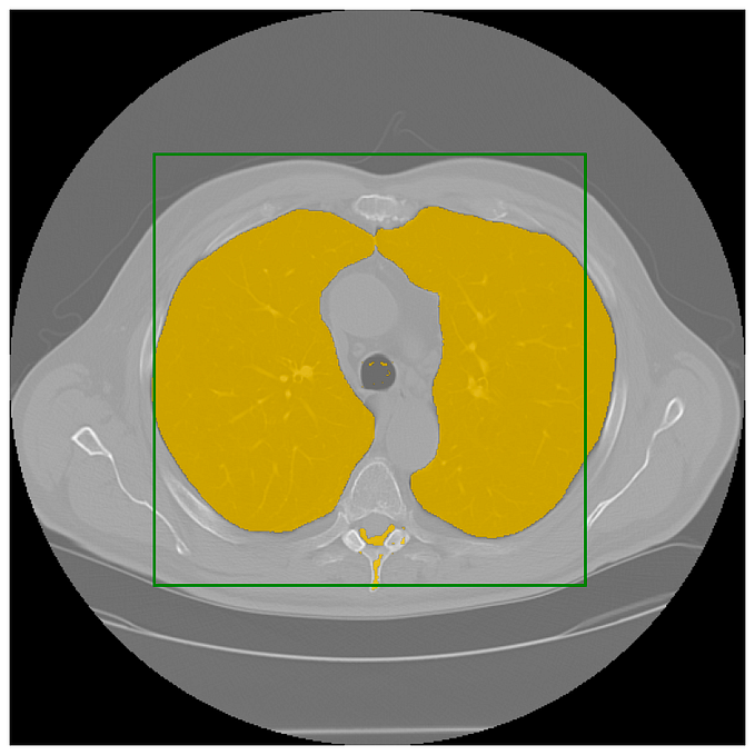 Segment Anything Model (SAM) on Apple Silicon M1 and M2