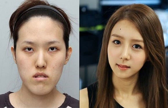 The Destructive Effects of South Korea’s Beauty Standards