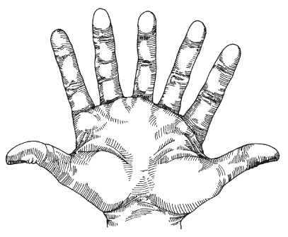 Are there humans with seven fingers on each hand? - Quora