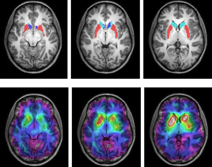 Image 17: 6 brain images
