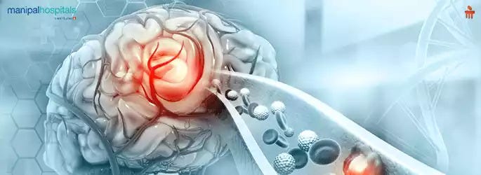 Blood Clot In Brain — Causes, Symptoms, Prevention | by Health Care ...