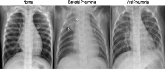 Building a Medical Image Classifier with Deep Learning and Python | by ...