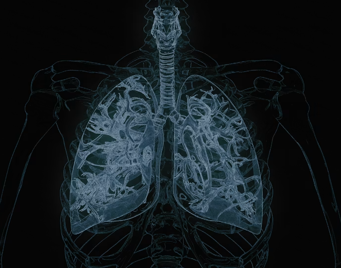 Why Some Cough Never Go Away: The Hidden Threat of Tuberculosis