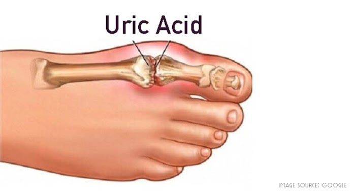 How To Control Uric Acid Level - Healthwealth - Medium