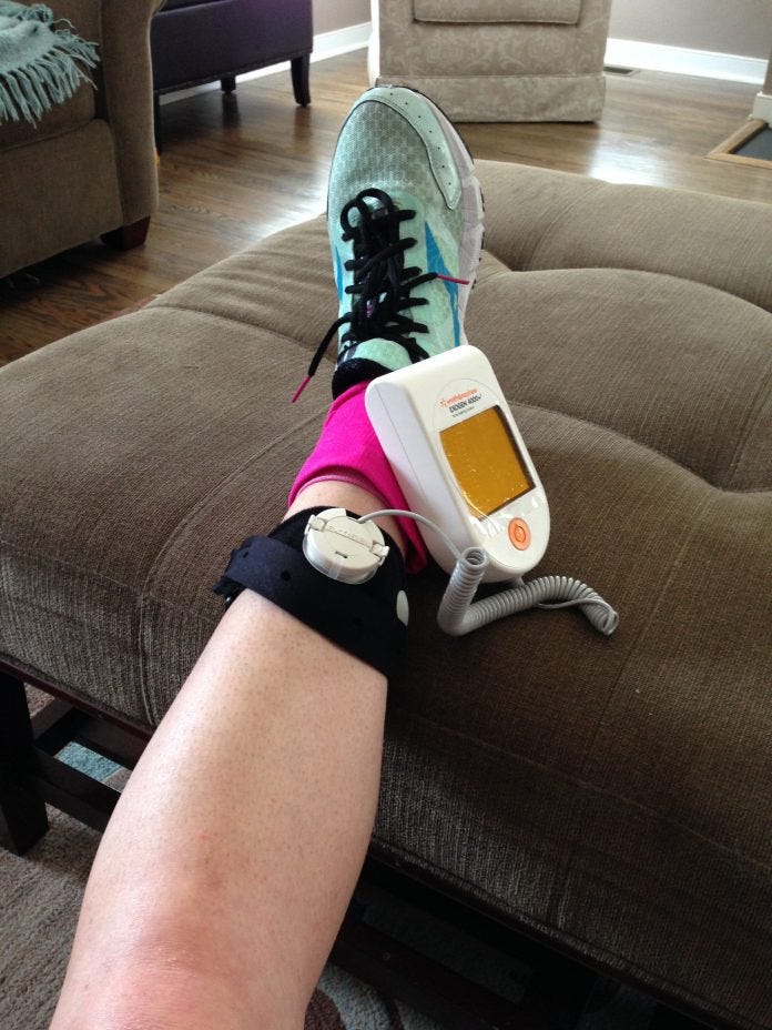 Bone Stimulator for Foot — What is it & Does it Work? by James