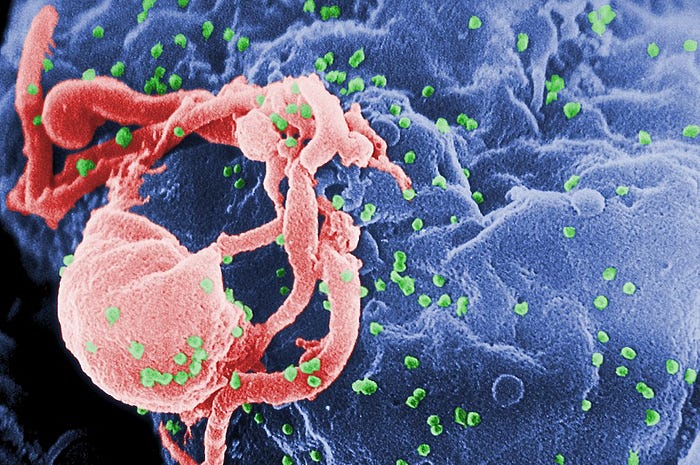 Colorized scanning electron microscope image showing a cluster of HIV particles (bright green dots) budding from the surface of a human immune cell. The cell is colored pink and has a textured, irregular shape with branching extensions. The background is a rough, blue-toned cellular surface. The image captures the process of viral replication and release.