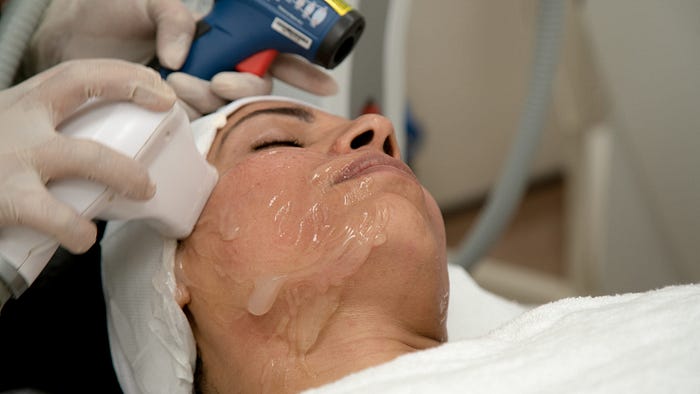 Why People Prefer Laser Hair Reduction Nowadays?