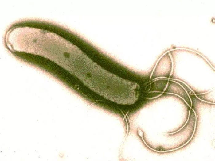 Refluxo ácido tem cura