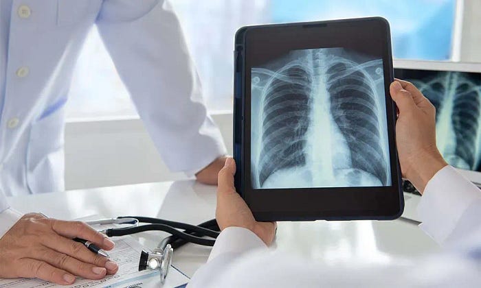 Revolutionizing Healthcare: The Power of Mobile Radiology