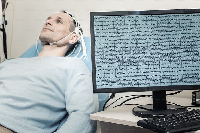 Neurofeedback. Amizur Nachshoni