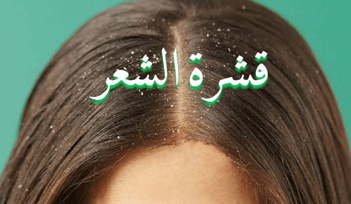 وصفات سحرية لعلاج قشرة الشعر بالأعشاب | by MoroccanGoods.Shop | May, 2023 |  Medium