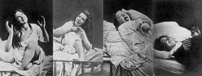 Hysteria dealt with by orgasm
