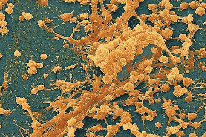 Biofilms