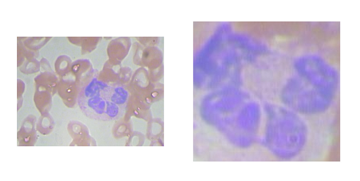 On the left is the original image and on the right is the cropped image of the white blood cell