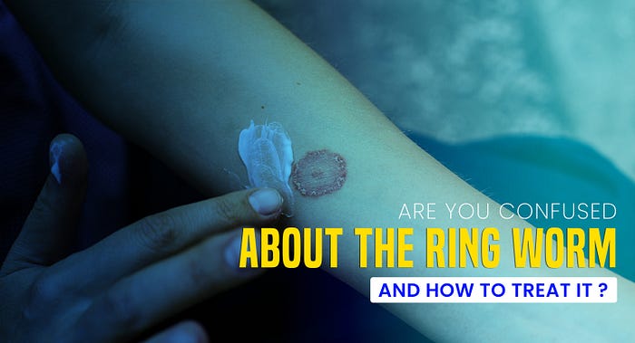 Ringworm How to Treat