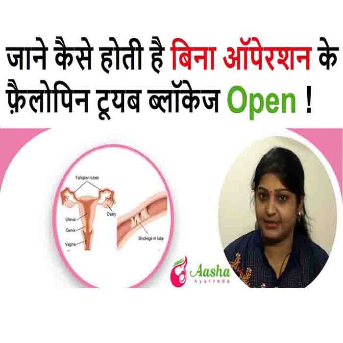 How Can Fallopian Tube Blockage Treatment Without Surgery Aasha