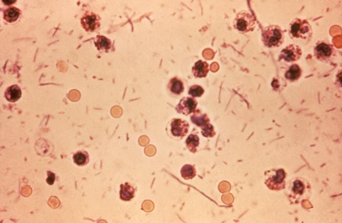 Centers for Disease Control and Prevention Publich Health Image Library — Centers for Disease Control and Prevention Publich Health Image Library