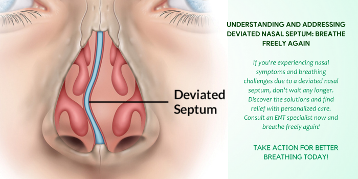 Deviated septum sale symptoms
