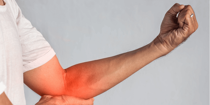 Ultrasound-Guided Cortisone and Hyaluronic Acid Injections for Golfer’s Elbow