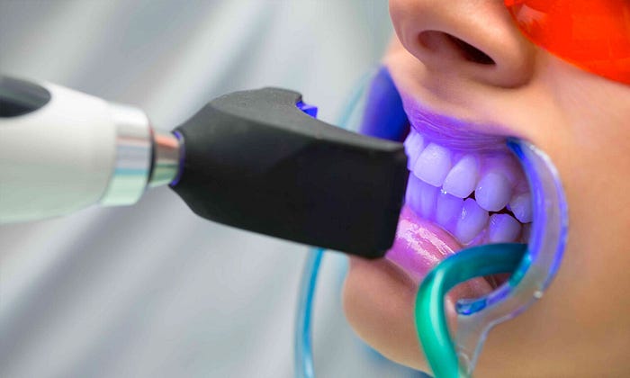 teeth whitening in ulwe