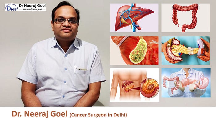 Stomach Cancer Treatment in Delhi