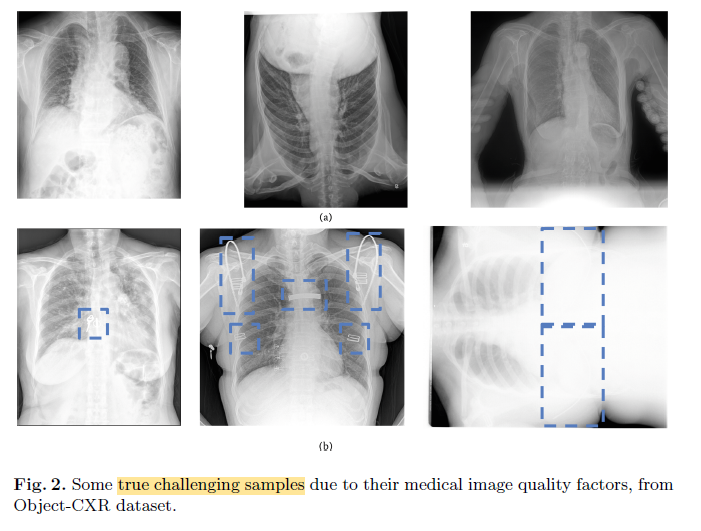 Object-CXR