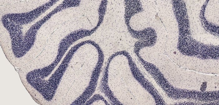 Rare, but essential  the amino acid selenocysteine | by Research Features  | Medium