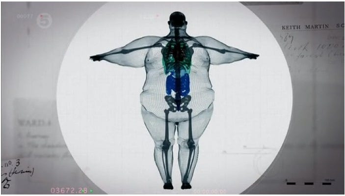 The Big Boned Theory. “I'm not really that overweight; I'm…, by Lori Boxer