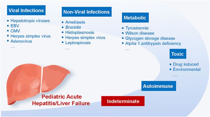 ACUTE Hepatitis