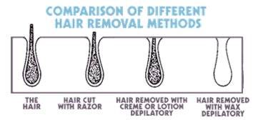 Hair Removal Methods From High School To Adulthood by SimoneSays