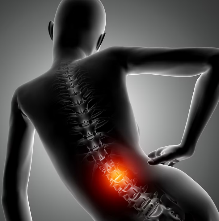 Rheumatoid Arthritis and Low Back Pain