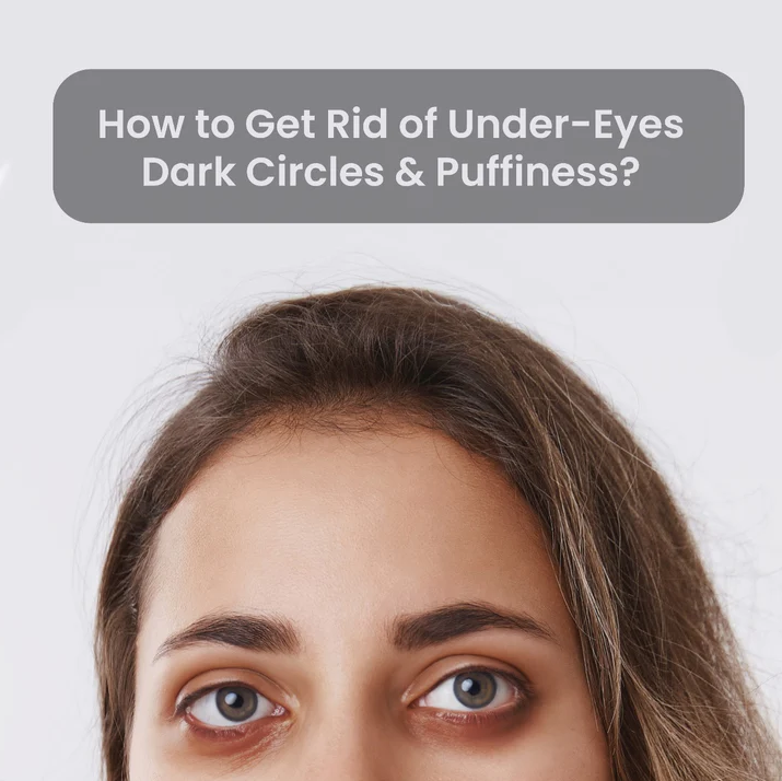 How to Get Rid of Puffy Eyes