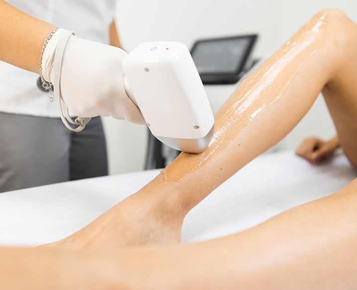 Bikini Laser Hair Removal — The Best Way to Be Rid of it Forever! by