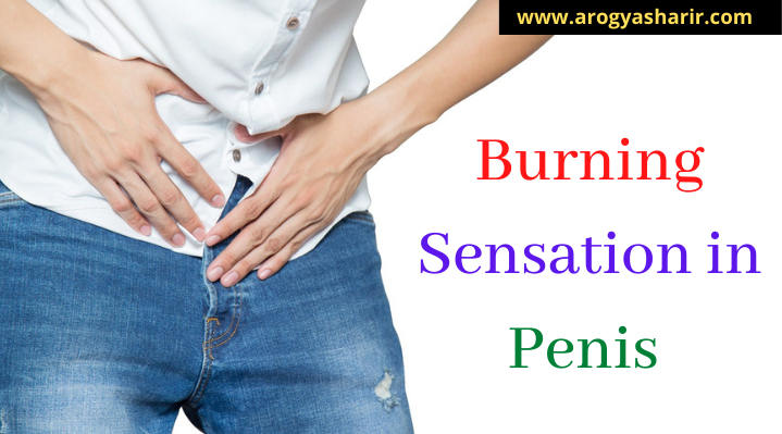 Burning sensation in penis — No 1 Best Tips | by Jyotiranjanraj | Medium
