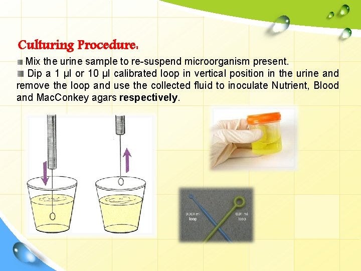 Pregnancy and Urinary Culture. The Urine Culture and Sensitivity Test