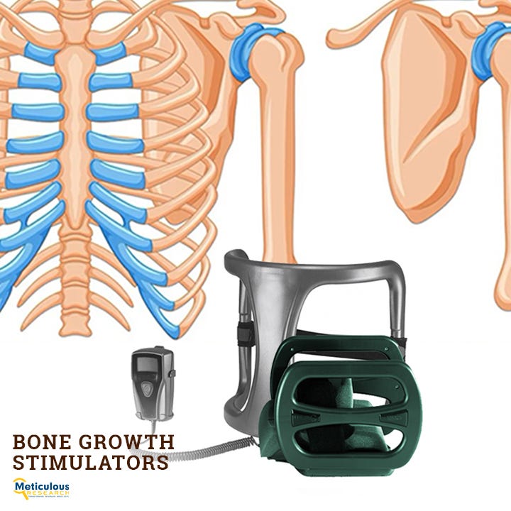 What Is a Bone Growth Stimulator and How Does It Work?