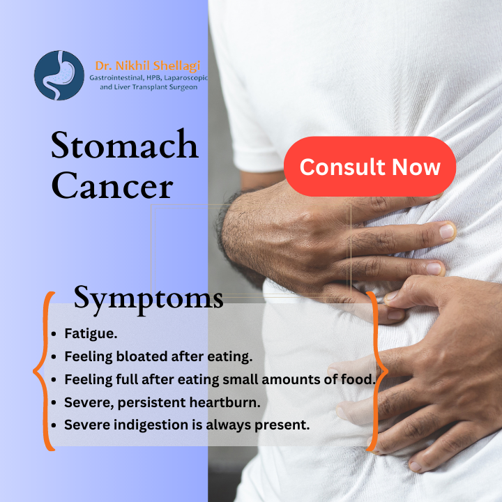 Stomach Cancer Ads - nikhil shell - Medium