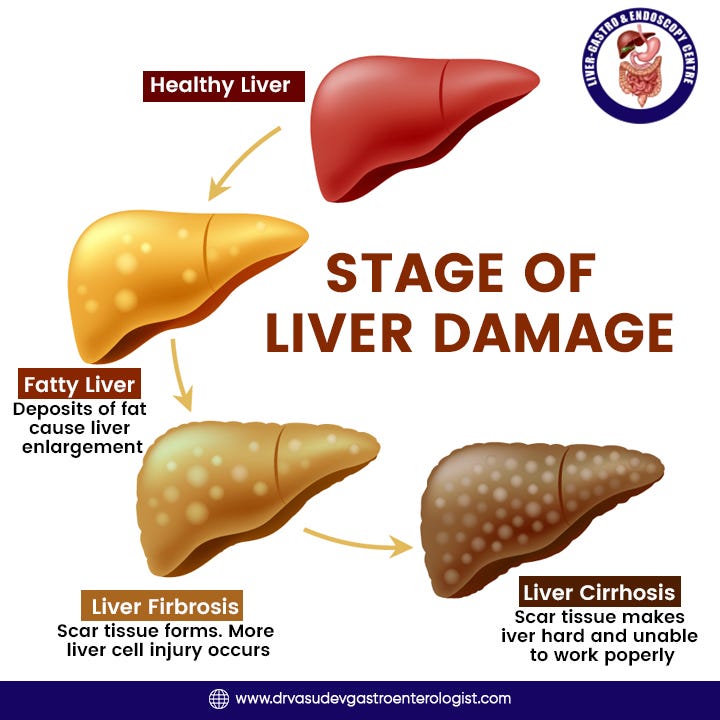 Liver Health Awareness - Super Trend - Medium