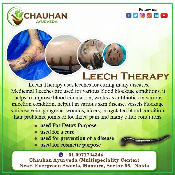 LEECH THERAPY chauhan Ayurveda Hospital Medium