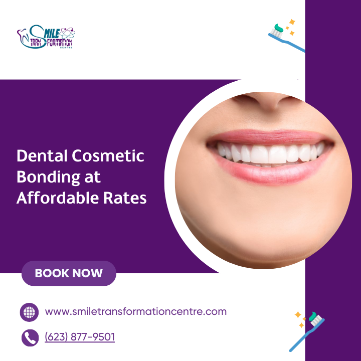 Know Everything about Dental Bonding Treatment by Smiletransformation
