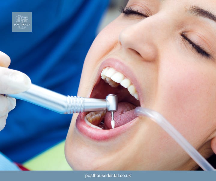 What is Gum Graft Surgery?. Gum Graft Surgery NHS involves taking… by