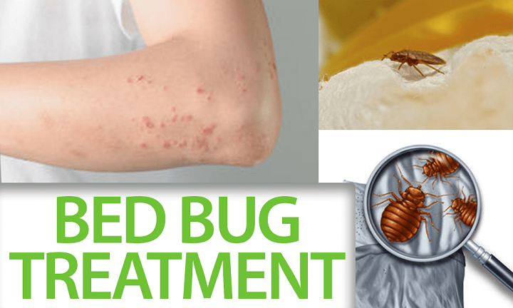 Facts You Need Know About The Bed Bug Treatment | by Hello PestControl |  Medium