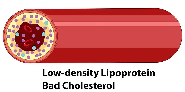 Lipoprotein (A) and its role in Infertility Lipoprotein (A) and its role in Infertility