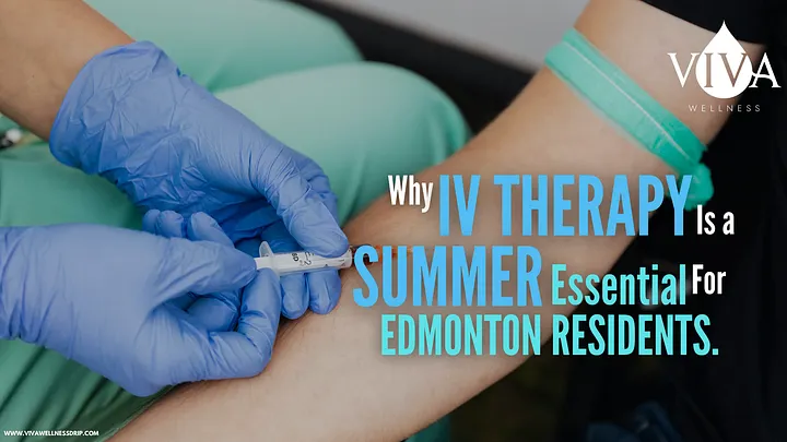 Top Reasons Edmonton Locals Ch Top Reasons Edmonton Locals Ch